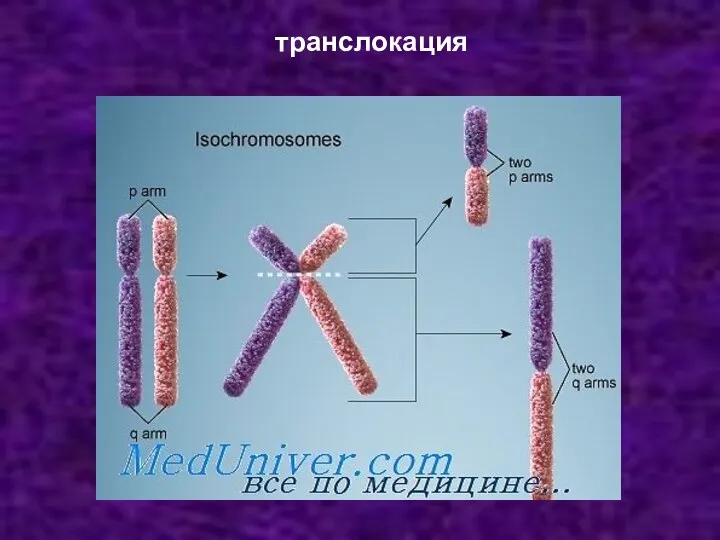 транслокация