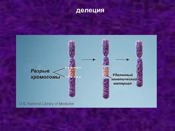 делеция