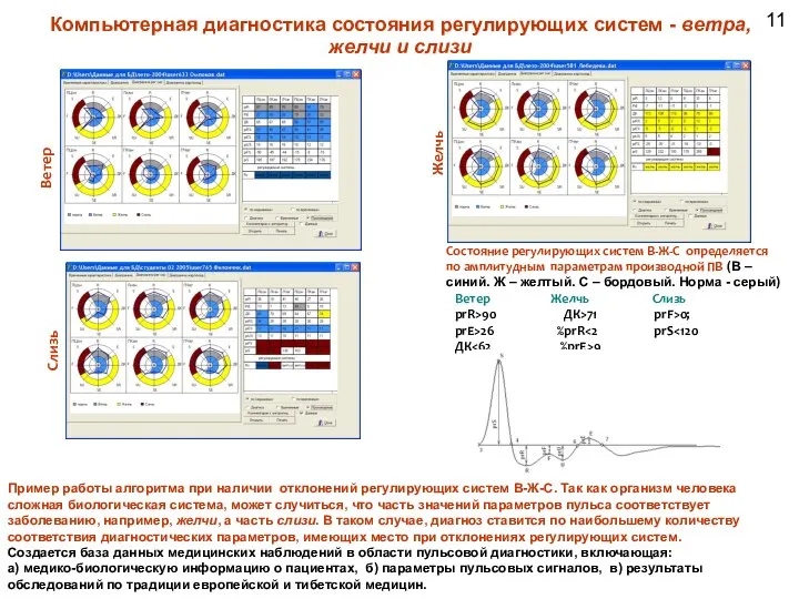Ветер Желчь Слизь Компьютерная диагностика состояния регулирующих систем - ветра, желчи и