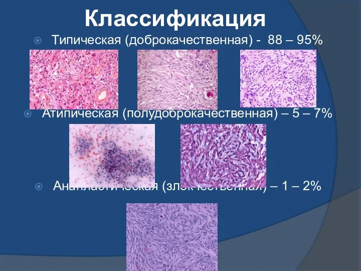 Классификация Типическая (доброкачественная) - 88 – 95% Атипическая (полудоброкачественная) – 5 –