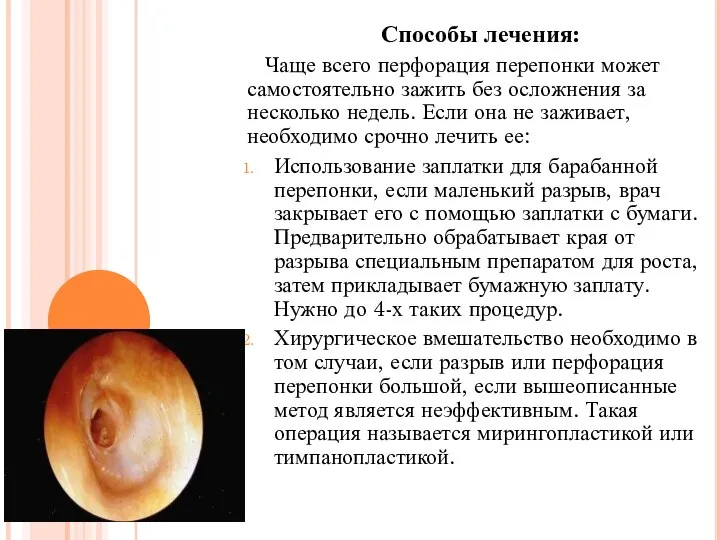Способы лечения: Чаще всего перфорация перепонки может самостоятельно зажить без осложнения за