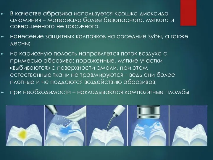 В качестве абразива используется крошка диоксида алюминия – материала более безопасного, мягкого