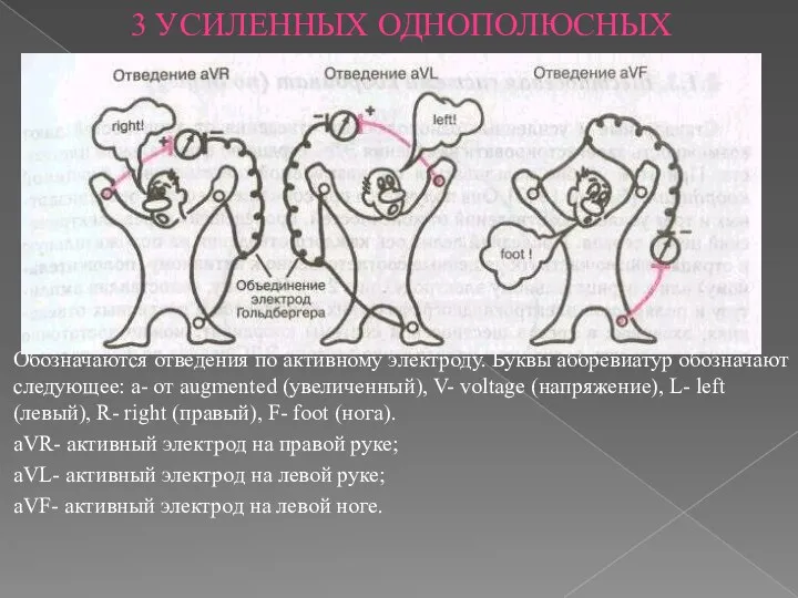 3 УСИЛЕННЫХ ОДНОПОЛЮСНЫХ Обозначаются отведения по активному электроду. Буквы аббревиатур обозначают следующее: