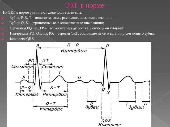 ЭКГ в норме: На ЭКГ в норме различают следующие элементы: Зубцы P,