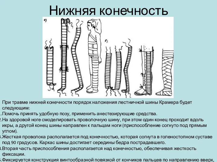 Нижняя конечность При травме нижней конечности порядок наложения лестничной шины Крамера будет