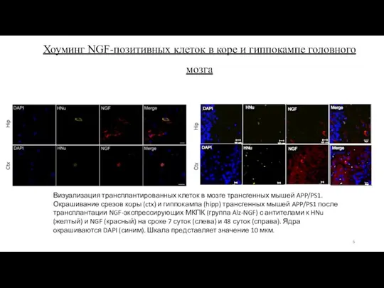 Хоуминг NGF-позитивных клеток в коре и гиппокампе головного мозга Визуализация трансплантированных клеток