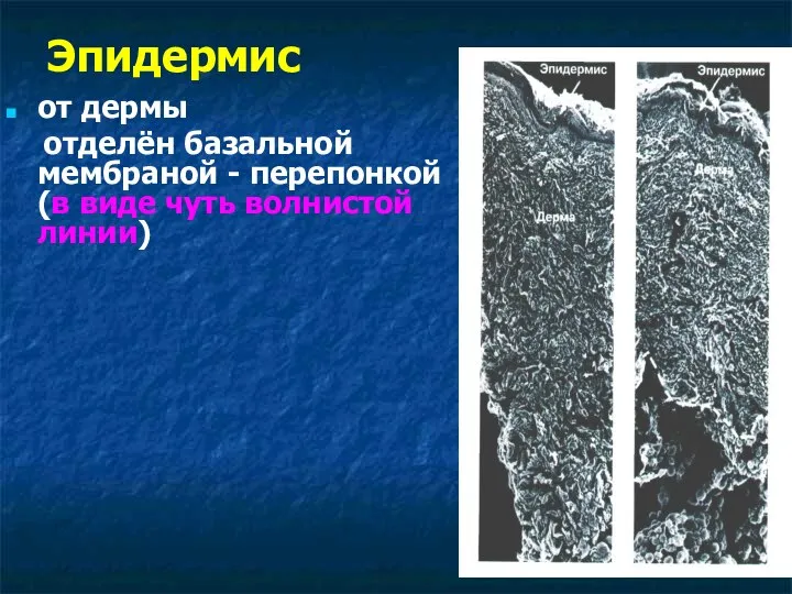 Эпидермис от дермы отделён базальной мембраной - перепонкой (в виде чуть волнистой линии)