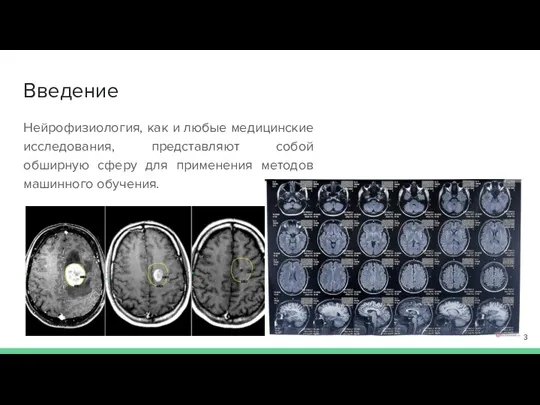 Введение Нейрофизиология, как и любые медицинские исследования, представляют собой обширную сферу для применения методов машинного обучения.