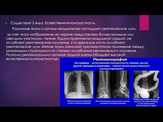 Существует 2 вида. Ествественная контрастность. Различные ткани и органы неодинаково поглощают рентгеновские