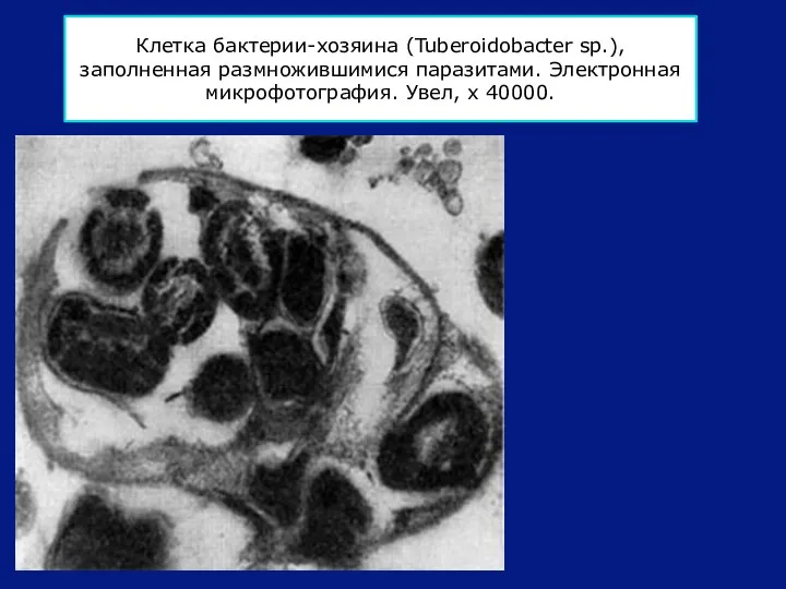 Клетка бактерии-хозяина (Tuberoidobacter sp.), заполненная размножившимися паразитами. Электронная микрофотография. Увел, х 40000.