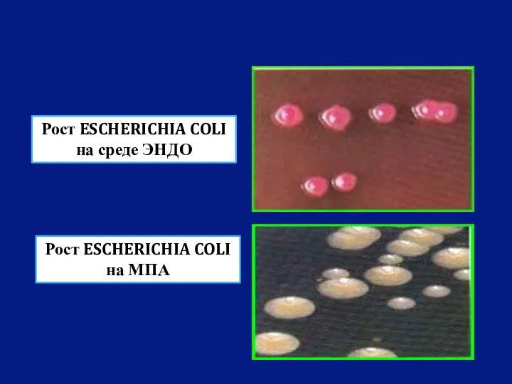 Рост ESCHERICHIA COLI на среде ЭНДО Рост ESCHERICHIA COLI на МПА