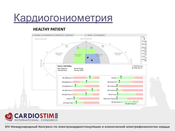 Кардиогониометрия