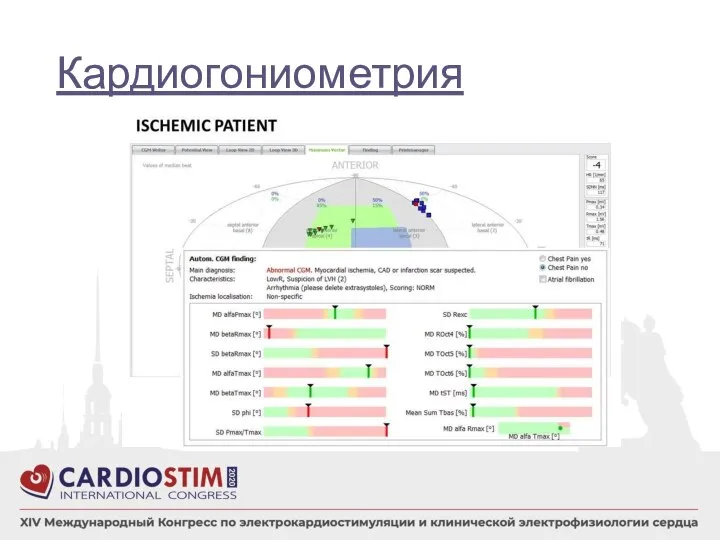 Кардиогониометрия