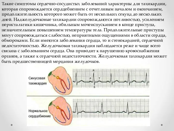 Такие симптомы сердечно-сосудистых заболеваний характерны для тахикардии, которая сопровождается сердцебиением с отчетливым
