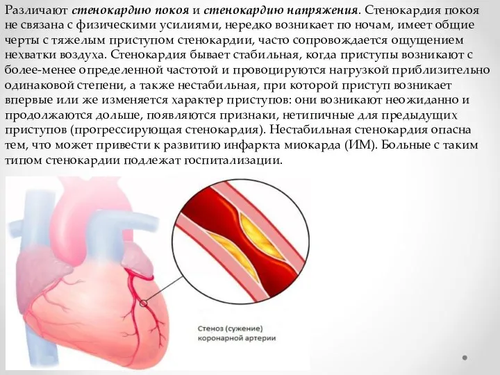 Различают стенокардию покоя и стенокардию напряжения. Стенокардия покоя не связана с физическими