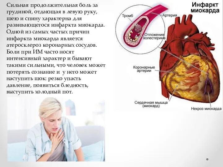 Сильная продолжительная боль за грудиной, отдающая в левую руку, шею и спину