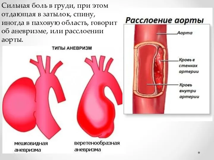 Сильная боль в груди, при этом отдающая в затылок, спину, иногда в