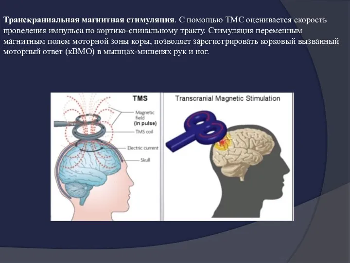 Транскраниальная магнитная стимуляция. С помощью ТМС оценивается скорость проведения импульса по кортико-спинальному