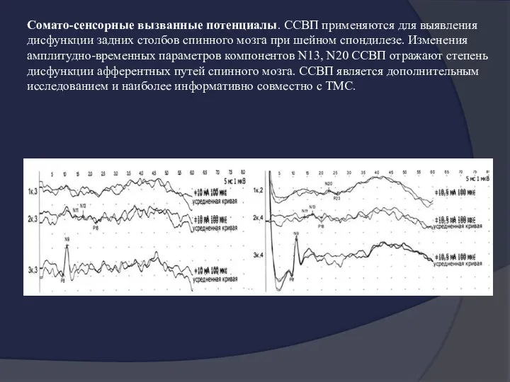 Сомато-сенсорные вызванные потенциалы. ССВП применяются для выявления дисфункции задних столбов спинного мозга