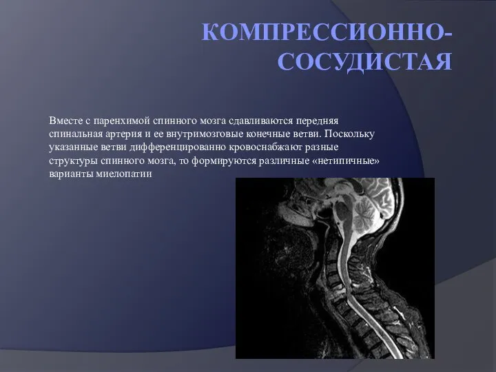 КОМПРЕССИОННО-СОСУДИСТАЯ Вместе с паренхимой спинного мозга сдавливаются передняя спинальная артерия и ее