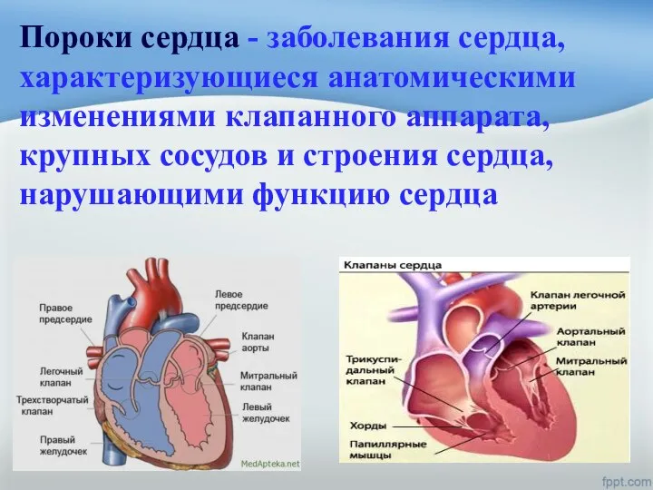 Пороки сердца - заболевания сердца, характеризующиеся анатомическими изменениями клапанного аппарата, крупных сосудов