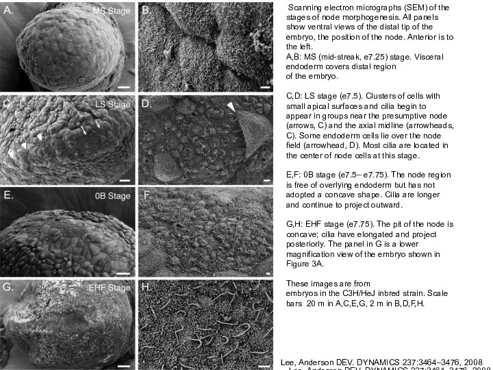 Scanning electron micrographs (SEM) of the stages of node morphogenesis. All panels