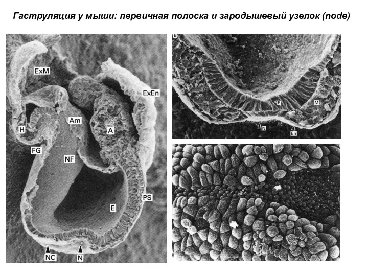 Гаструляция у мыши: первичная полоска и зародышевый узелок (node)