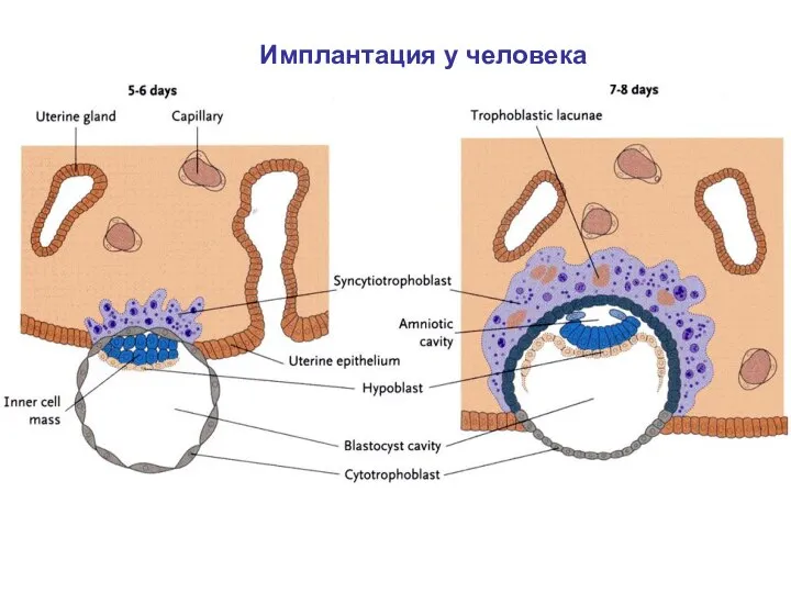 Имплантация у человека