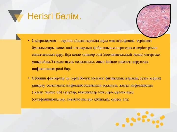 Негізгі бөлім. Склеродермия— терінің айқын тыртықтануы мен атрофиясы түріндегі бұзылыстары және ішкі