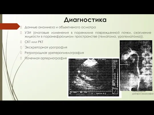 Диагностика Данные анамнеза и объективного осмотра УЗИ (очаговые изменения в паренхиме поврежденной