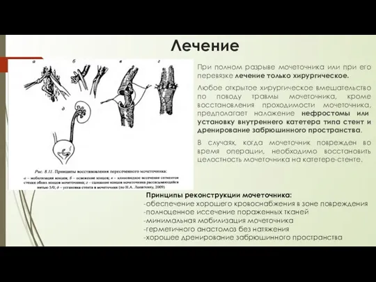 Лечение При полном разрыве мочеточника или при его перевязке лечение только хирургическое.