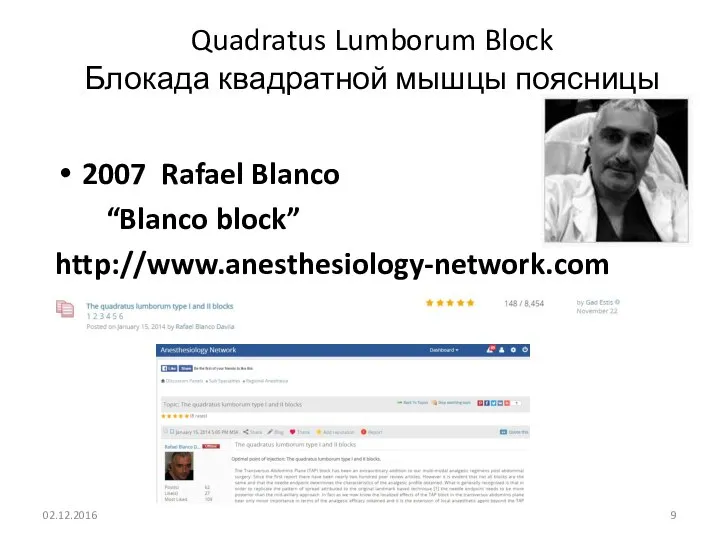 Quadratus Lumborum Block Блокада квадратной мышцы поясницы 2007 Rafael Blanco “Blanco block” http://www.anesthesiology-network.com 02.12.2016