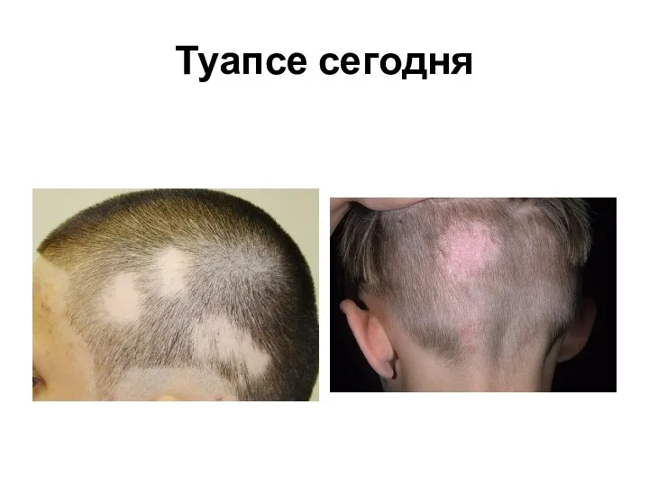 Туапсе сегодня