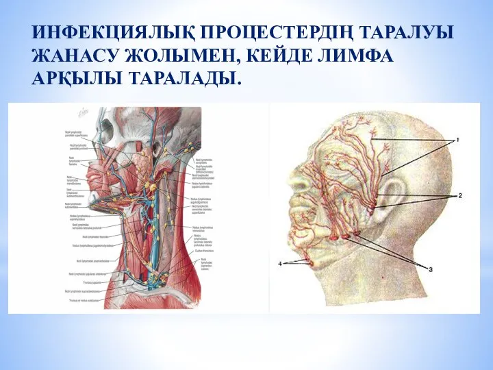 ИНФЕКЦИЯЛЫҚ ПРОЦЕСТЕРДІҢ ТАРАЛУЫ ЖАНАСУ ЖОЛЫМЕН, КЕЙДЕ ЛИМФА АРҚЫЛЫ ТАРАЛАДЫ.