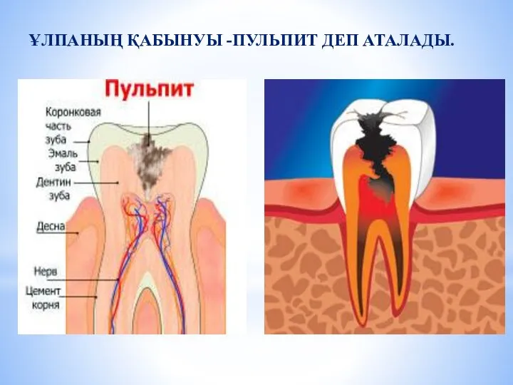 ҰЛПАНЫҢ ҚАБЫНУЫ -ПУЛЬПИТ ДЕП АТАЛАДЫ.