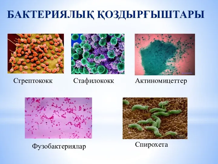 БАКТЕРИЯЛЫҚ ҚОЗДЫРҒЫШТАРЫ Стрептококк Стафилококк Фузобактериялар Спирохета Актиномицеттер