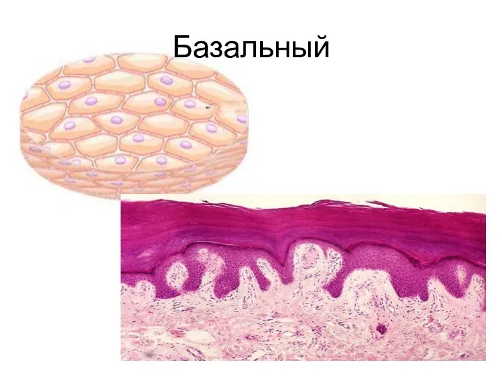 Базальный