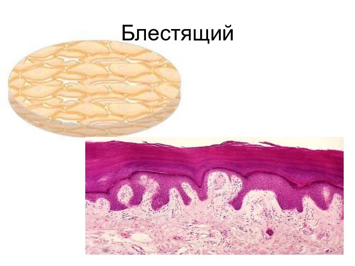 Блестящий