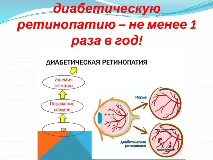 Скрининг на диабетическую ретинопатию – не менее 1 раза в год!