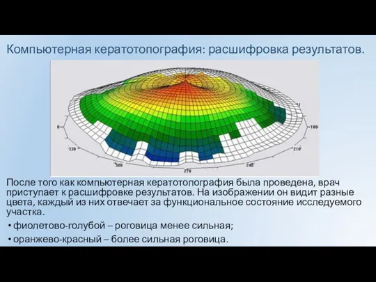 Компьютерная кератотопография: расшифровка результатов. После того как компьютерная кератотопография была проведена, врач