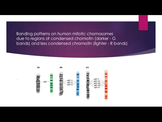 Banding patterns on human mitotic chomosomes due to regions of condensed chomatin