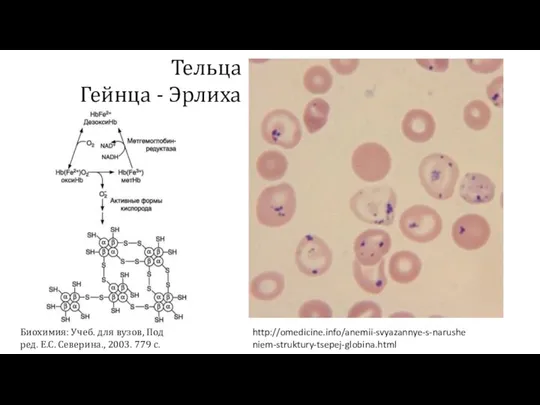 http://omedicine.info/anemii-svyazannye-s-narusheniem-struktury-tsepej-globina.html Биохимия: Учеб. для вузов, Под ред. Е.С. Северина., 2003. 779 с. Тельца Гейнца - Эрлиха