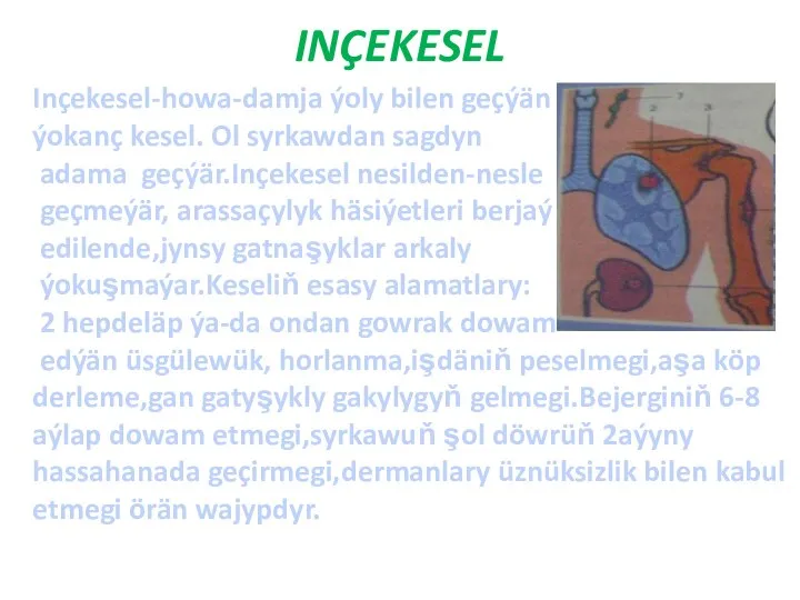 INÇEKESEL Inçekesel-howa-damja ýoly bilen geçýän ýokanç kesel. Ol syrkawdan sagdyn adama geçýär.Inçekesel