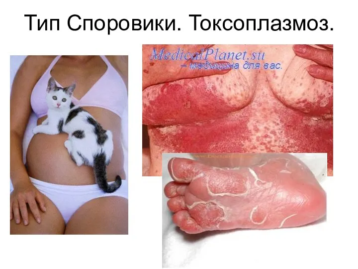 Тип Споровики. Токсоплазмоз.