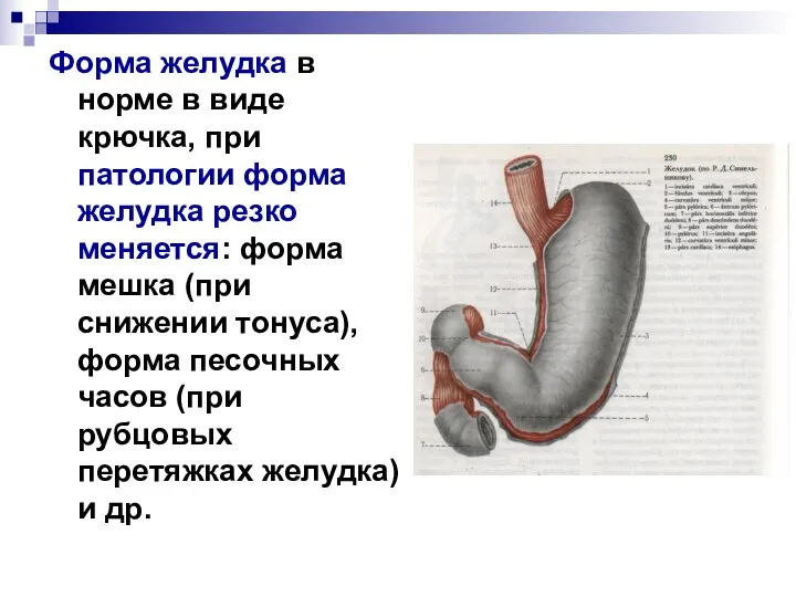Форма желудка в норме в виде крючка, при патологии форма желудка резко
