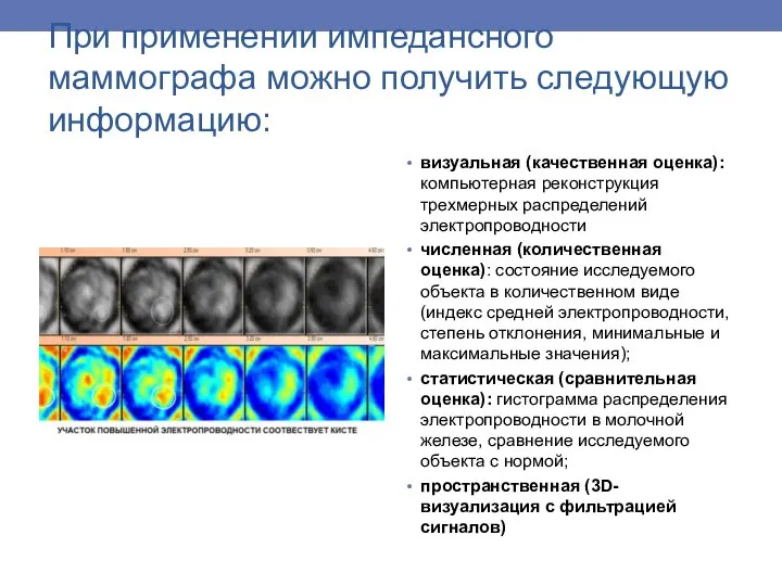 При применении импедансного маммографа можно получить следующую информацию: визуальная (качественная оценка): компьютерная