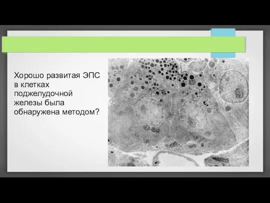 Хорошо развитая ЭПС в клетках поджелудочной железы была обнаружена методом?