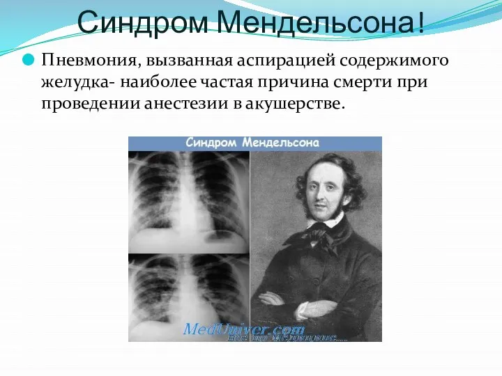 Синдром Мендельсона! Пневмония, вызванная аспирацией содержимого желудка- наиболее частая причина смерти при проведении анестезии в акушерстве.