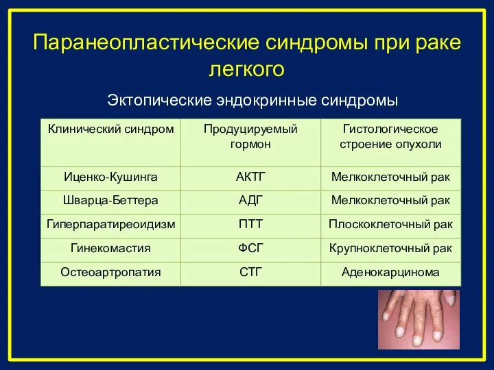 Паранеопластические синдромы при раке легкого Эктопические эндокринные синдромы