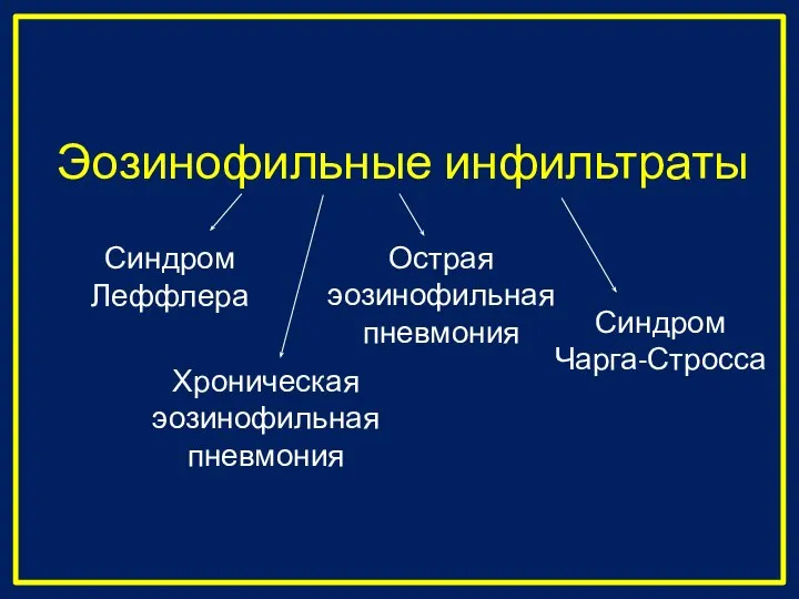 Эозинофильные инфильтраты Синдром Леффлера Острая эозинофильная пневмония Синдром Чарга-Стросса Хроническая эозинофильная пневмония